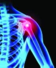 Боли в плече: причины и лечение